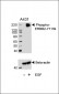 Phospho-ERBB2(Y1139) Antibody