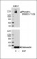 Phospho-ERBB2(Y1139) Antibody