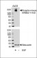 Phospho-M ERBB2(Y1140) Antibody