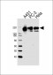 EGFR-S1026 Antibody (C-term)