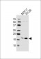 AGR2 Antibody (Center)