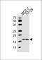 AGR2 Antibody (Center)