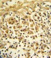 ENO1 Antibody (Center)