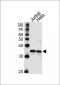 TYSY Antibody (C-term)