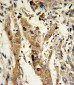 GSTM1 Antibody (C-term)