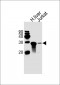 GSTM1 Antibody (C-term)