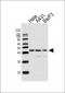 PGK1 Antibody (Center S320)
