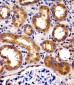 SPHK1 Antibody (N-term P74)