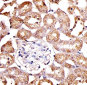 SPHK1 Antibody (N-term P74)