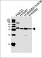 SPHK1 Antibody (N-term P74)