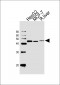 IDH1 Antibody (Center)