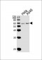 BRK (PTK6) Antibody (N-term)