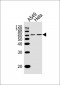 ESRRG Antibody (Center)