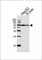 GCK Antibody (N-term)