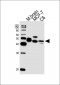 MEK2 (MAP2K2) Antibody (Center)