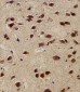 NEK2 Antibody (Center)