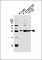 OLR1 Antibody (Center)