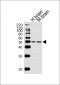 GCGR Antibody (Center)