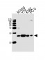 GSTP1 Antibody (Center)