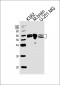 BAIAP2 Antibody (C-term)