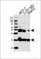 CTSD Antibody