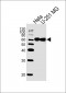 FUBP3 Antibody (N-term)