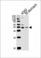 BLMH Antibody (Center)