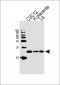 TPT1 Antibody (N-term)