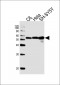 CALR Antibody