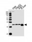 CYB5R3 Antibody (Center)