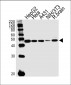 TUFM Antibody (N-term)