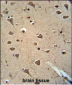 ALDH2 Antibody