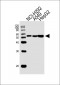 ALDH2 Antibody