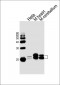 NDUFS7 Antibody (Center)