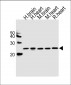 PRDX2 Antibody (C-term)