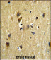 STIP1 Antibody (Center)