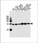 UCHL1 Antibody (C-term)