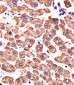 ATP5B Antibody (Center)