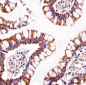ATP5B Antibody (Center)