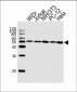 ATP5B Antibody (Center)