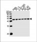 PGK1 Antibody (Center)