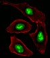 DHX9 Antibody (N-term)