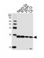 UCHL1 Antibody (C-term)