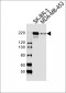 ERBB2 Antibody