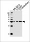 SOX8 Antibody (Center)