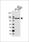 ITGB2 Antibody