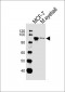 COL9A1 Antibody (Center)