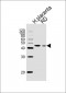 ACTA1/α-actin Antibody (C-term)