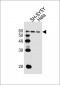 HDAC2 Antibody (Center)