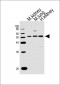 NR2F1 Antibody (N-term)